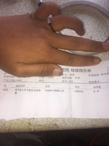 前几天我做了无痛人流，流产后休息几天能上班？